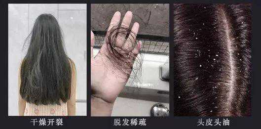 春天一把一把掉头发？日常这样做，头发黑亮浓密