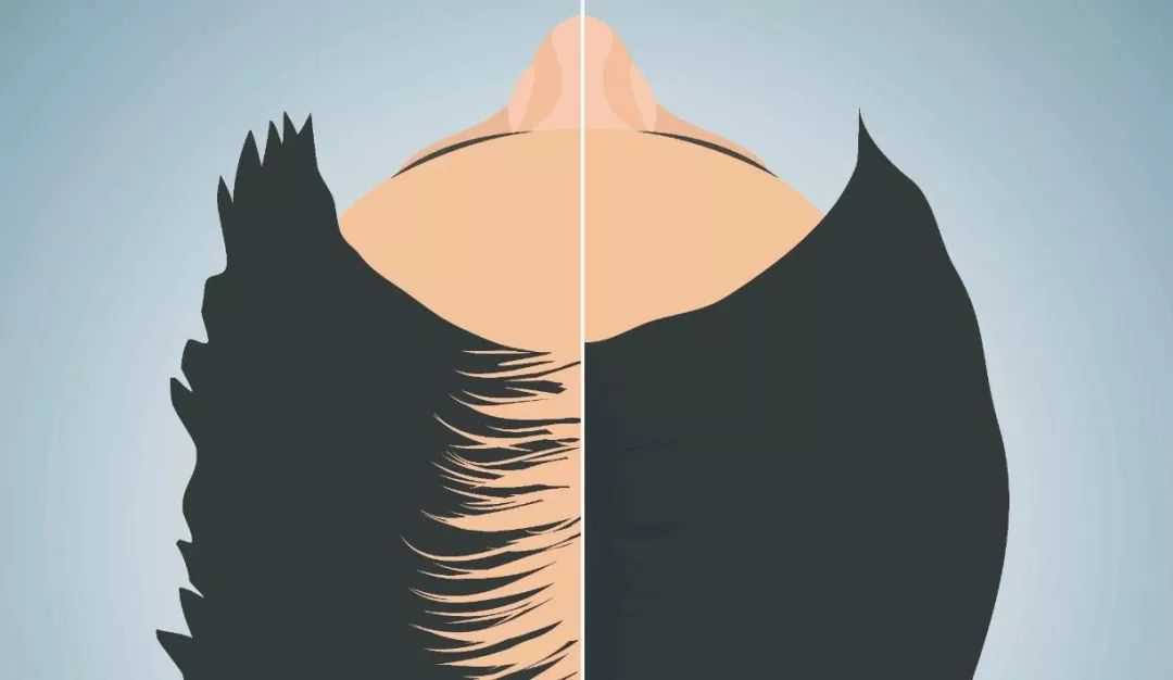 让 2 亿中国人狂掉头发的元凶抓到了，快了解一下