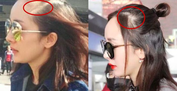 比变老更可怕的是“头发稀疏”，年纪越大越明显，老10岁不止