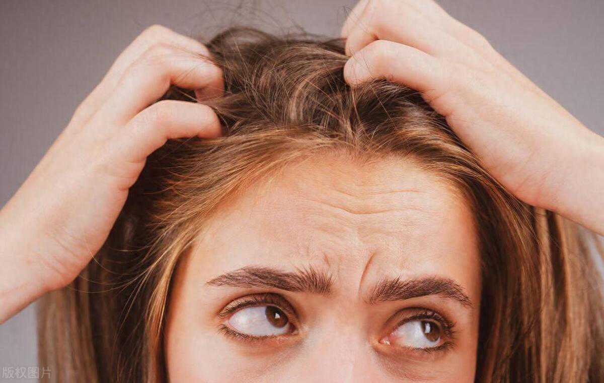 头发突然变稀疏？甲状腺问题可能是元凶，为何女性更易受影响？