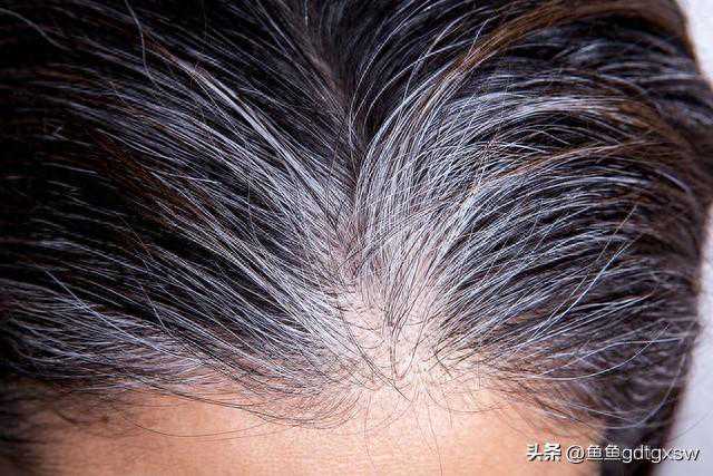 白头发太多怎么办？正确的染发小妙招，能把对身体的危害降到最低